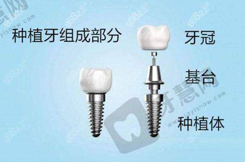 广东东莞清溪莞口口腔医院地址电话