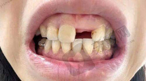 徐州沛县牙管家口腔正规吗?