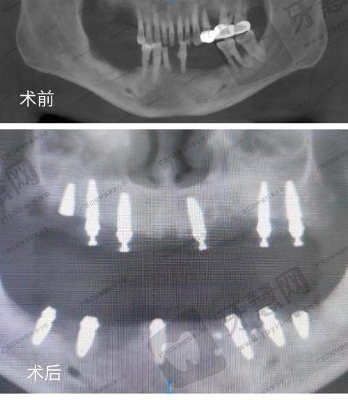 江苏徐州睢宁牙百佳口腔门诊部正规吗?