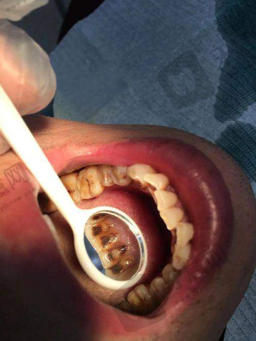 东莞寮步莞口口腔总院(原莞大)医院地址电话