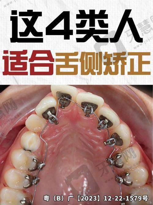 东莞好佰年口腔医院诊疗项目