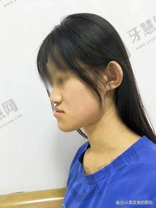 江苏徐州邳州牙卫士口腔医院口碑如何
