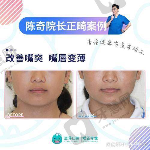 江苏徐州睢宁牙百佳口腔门诊部口碑如何