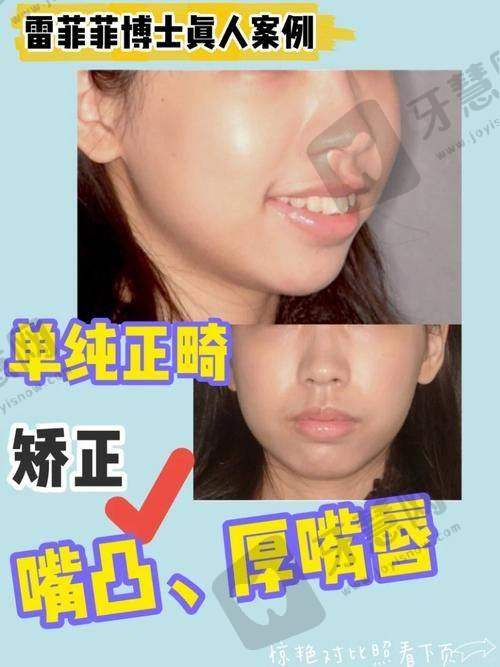 江苏徐州邳州牙卫士口腔医院预约挂号