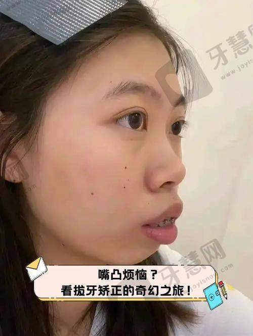 广东东莞石排莞口口腔医院价格表/收费标准2025年