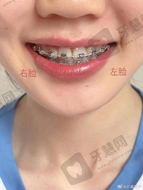 佛山春芽口腔医院医生介绍