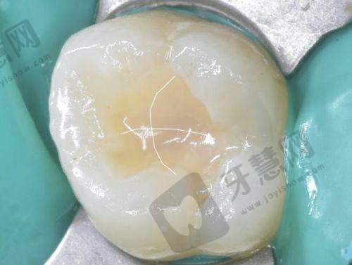 广东东莞石排莞口口腔医院口碑如何