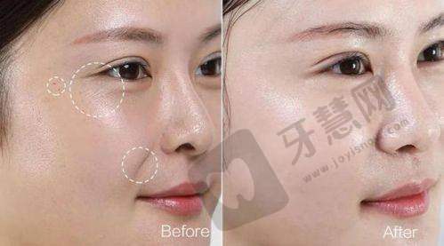 广东东莞石排莞口口腔医院正规吗?