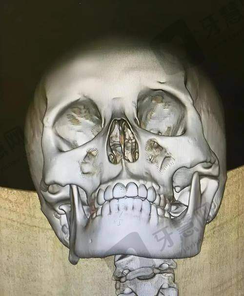 广东东莞石排莞口口腔医院怎么样?