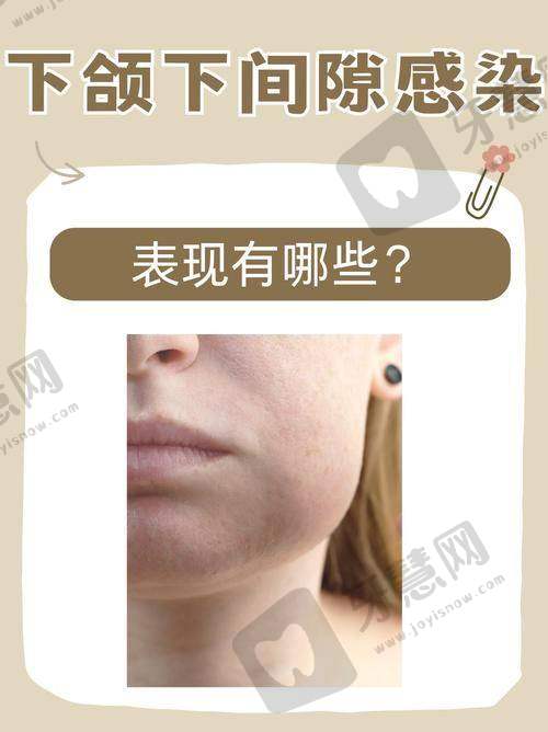 广东东莞石碣专致口腔诊疗项目