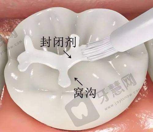 沈阳欢乐口腔医院地址电话