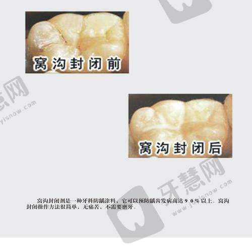 广东东莞清溪莞口口腔医院正规吗?