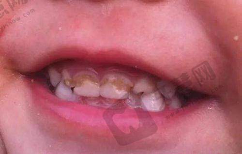 东莞寮步莞口口腔总院(原莞大)医院价格表/收费标准2025年