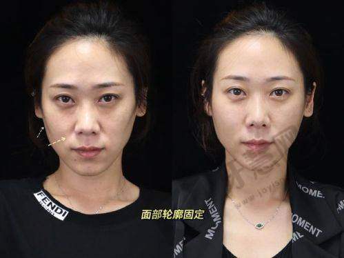 瑞金市人民医院整形美容科地址电话营业时间