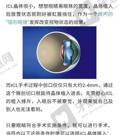 王立东医生坐诊医院:广州视百年眼科