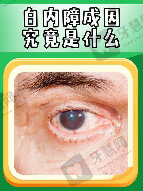5. 前列技术同步国内外,手术设备与材料优选