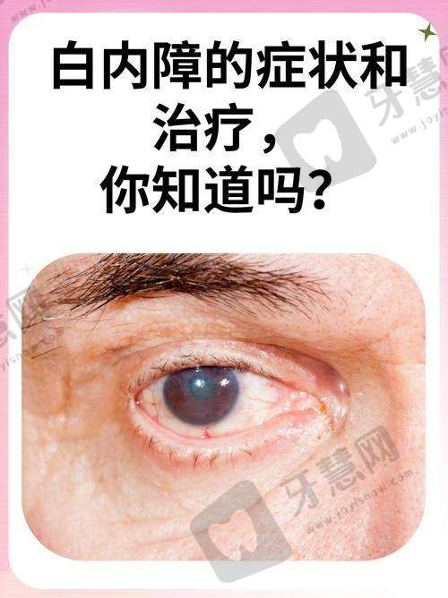 实例3：复杂白内障合并高度近视，联合手术解决20年困扰