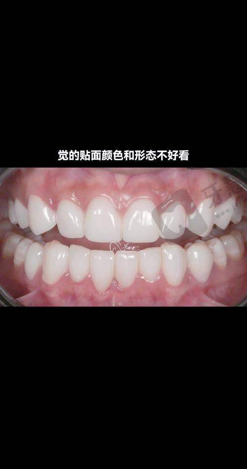 东莞黄江莞口口腔门诊预约挂号