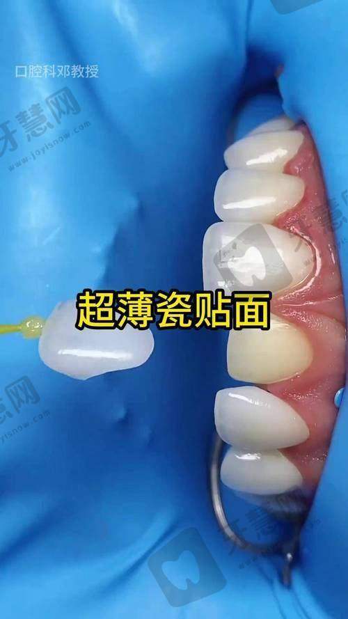山西众植齿科医院（太原）口碑如何