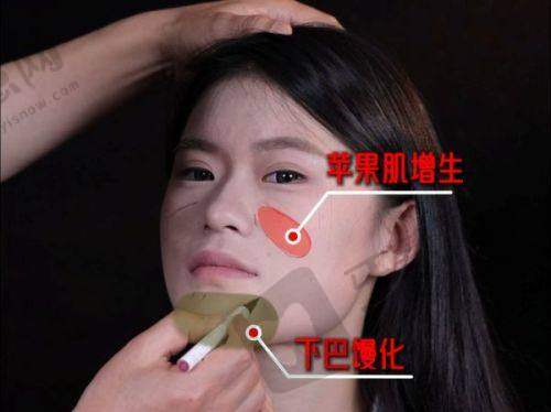上海九院美容整形外科挂号预约注意事项