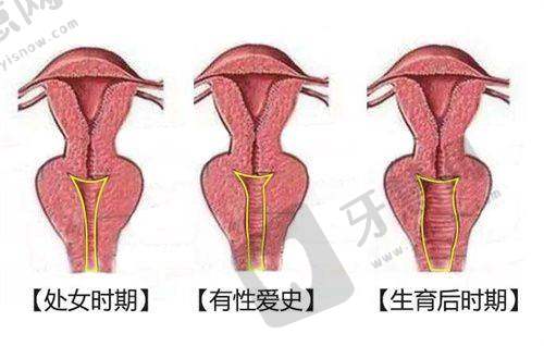 上海馥兰朵医院环境及医生团队助力双眼皮成效