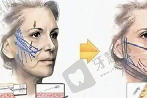 上海东方丽人医疗美容门诊部地址电话营业时间