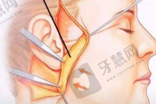 北京奥尔贝德医院整形口碑大起底地址