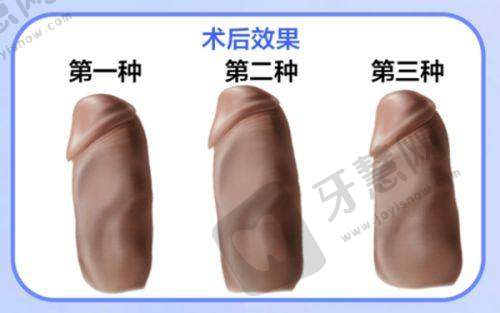 南京华韩奇致美容医院怎么样之收费情况