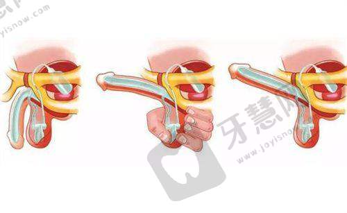 上海九院眼部整形手术价格与优势