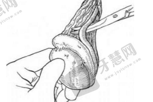 成本剖析与省钱秘籍