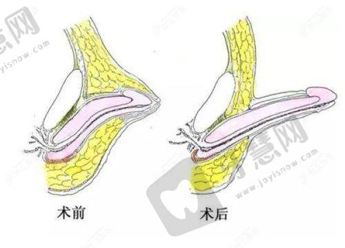 佛山石肯医院女性私密整形科是国有的吗？