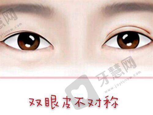 贵阳隆鼻排名前十的医生之刘照