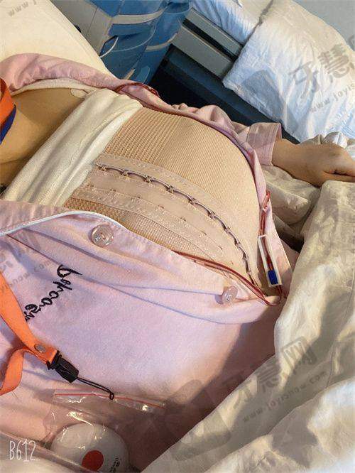 南京吸脂去哪家——南京友谊整形外科医院