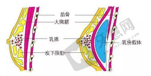 西安伊美尔医疗美容医院收费合理性揭秘