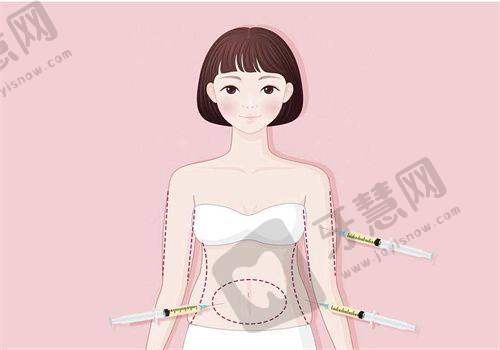 正规医院隆胸需要多少钱——不同医院隆胸价格对比分析