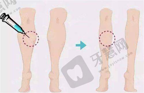 上海馥兰朵周美兰医生眼部整形技术特色