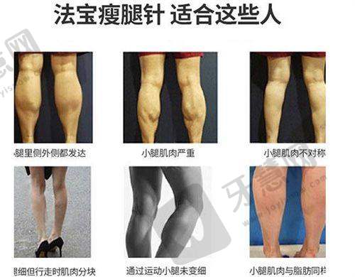 贵阳隆鼻多少钱？对比利美康、美贝尔收费，医生技术口碑揭秘