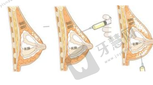 北京奥尔贝德医院整形口碑大起底怎么样