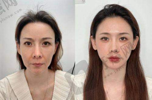 东莞长安安美聚光医疗美容门诊部口碑如何