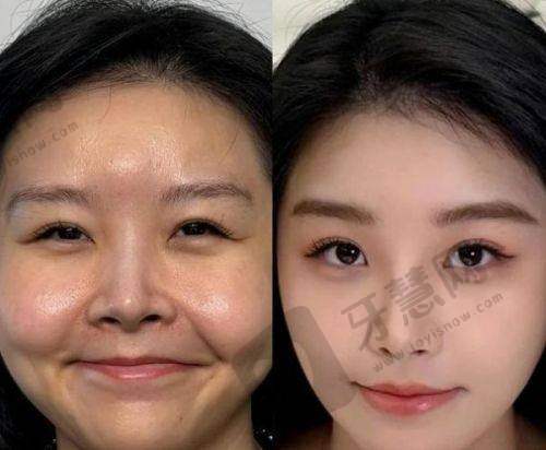 上海九院美容整形外科电话询问的优势