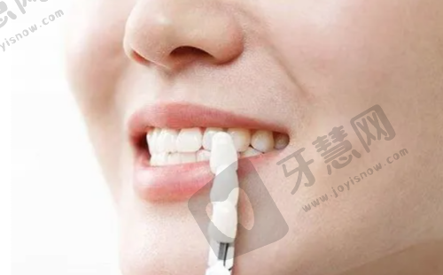 朝阳区国有口腔医院有哪些