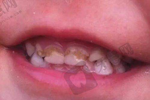 常见口腔项目价格参考