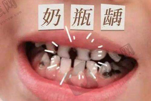 上海沐良诚口腔怎么样，正畸好不好？正规机构+10年经验医生给保障