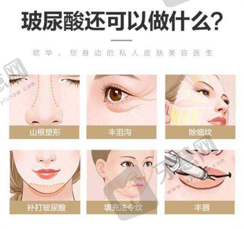 合肥双眼皮修复周瑜做的好吗?——实际实例验证