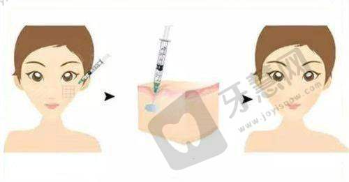 正规医院隆胸需要多少钱——成都后美医疗美容医院的收费及优势