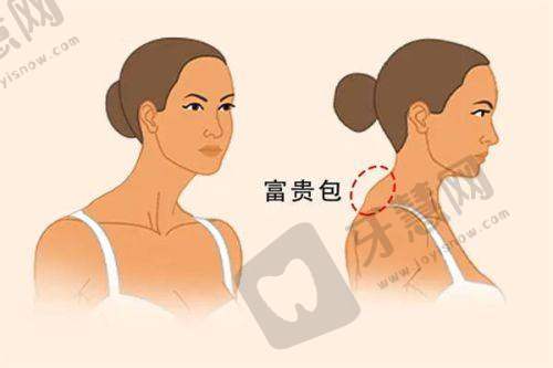 西安伊美尔医疗美容医院医生技术水平如何