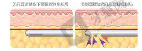 2025北京专门做异物取出的医院叫什么