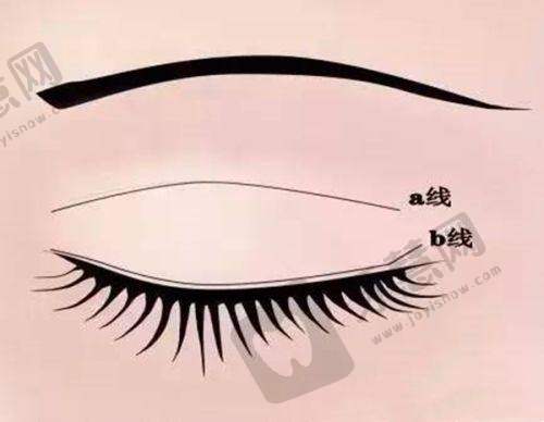 南京吸脂去哪家——南京施尔美整形美容医院