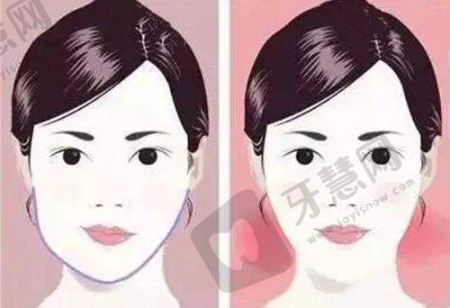 贵阳腹壁整形医院哪家好——国有三等甲医院的优势与选择