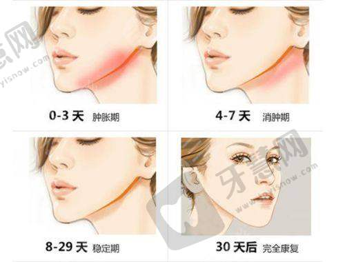 上海东方丽人医疗美容门诊部收费价格表/收费标准